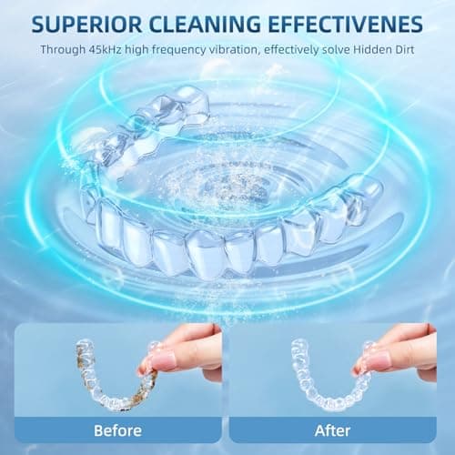 Ultrasonic Retainer Cleaner Machine, Upgraded 45kHz Ultrasonic Cleaner for Mouth Guard Braces, Night Guards, Toothbrush Heads & Jewlery with 200ML, 4 Modes and Digital Timer Dental Cleaning Pod (Light Blue)