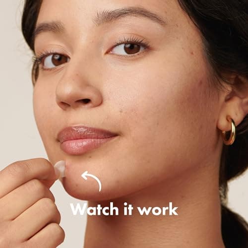 Hero Cosmetics Mighty Patch Original Nighttime Acne Pimple Patches, 75 Ct — view 2