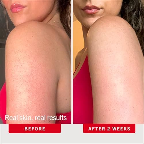 First Aid Beauty KP Bump Eraser Body Scrub with 10% AHA - Dermatologist-Tested Keratosis Pilaris Exfoliator - Support for Rough Bumps, Uneven Skin Texture & Strawberry Skin - Sensitive Skin - 10 oz — view 3