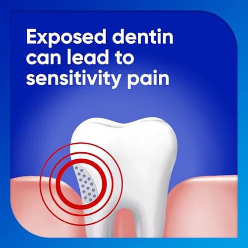 Sensodyne Extra Whitening Sensitive Teeth and Cavity Prevention Whitening Toothpaste, Amazon Exclusive, Cool Mint, Amazon Exclusive- 4 Ounces (Pack of 4) — view 3