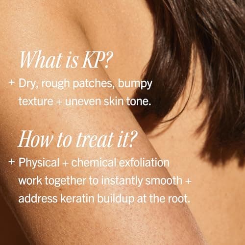 First Aid Beauty KP Bump Eraser Body Scrub with 10% AHA - Dermatologist-Tested Keratosis Pilaris Exfoliator - Support for Rough Bumps, Uneven Skin Texture & Strawberry Skin - Sensitive Skin - 10 oz — view 4