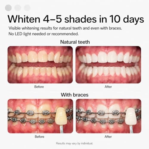 Opalescence Go 15 - Prefilled Teeth Whitening Trays - 15% Hydrogen Peroxide - (10 Treatments) Made by Ultradent Products. Teeth Whitening Kit -Mint - Includes 2Chill Toothbrush 5194-1T — view 3